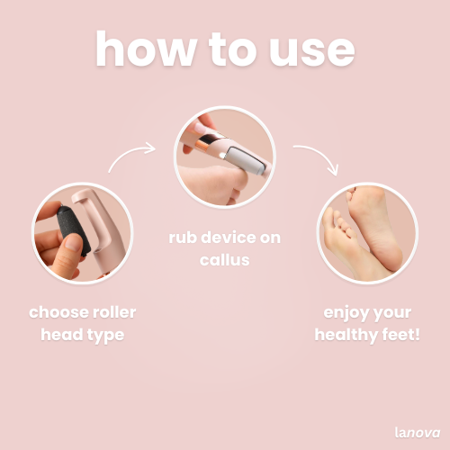 lanova callus remover